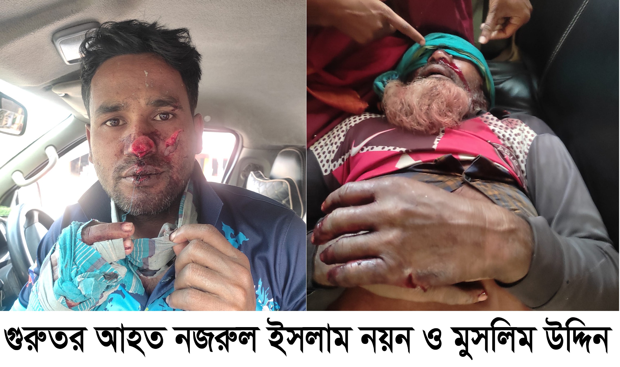ঈশ্বরগঞ্জে জমি সংক্রান্ত বিরোধে দুই গ্রুপের সংঘর্ষ, আহত ৯